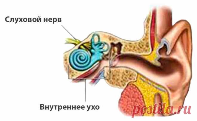 Неврит слухового нерва. Лечение неврита слухового нерва народными средствами | Народная медицина