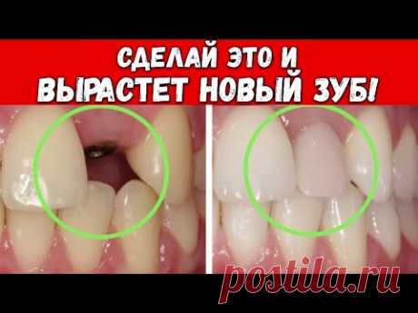 Как Вырастить НОВЫЕ ЗУБЫ в ЛЮБОМ ВОЗРАСТЕ? Стоматологам ЗАПРЕЩЕНО об этом говорить!