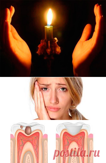 Заговоры от зубной боли: обзор наиболее сильных вариантов