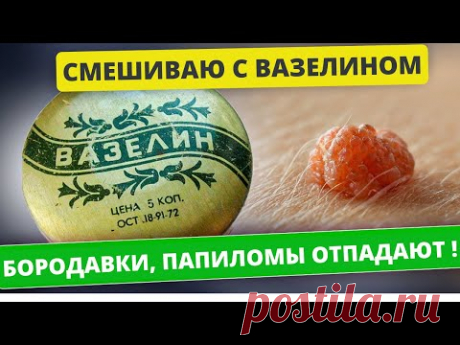 Как избавиться от ПАПИЛЛОМ, БОРОДАВОК и других кожных образований народными средствами за 1 день!