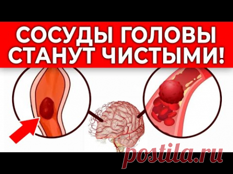 Пей ЭТО от головной боли! Сосуды головы станут ЧИСТЫМИ! | 3 способа очистить сосуды