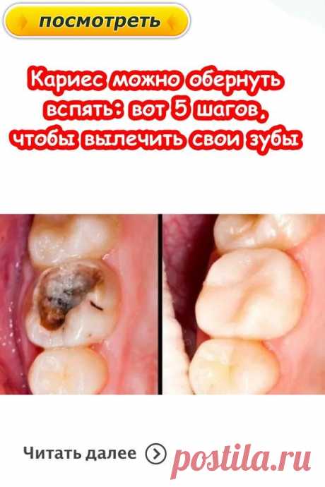 #здоровье	
#дляздоровья
#оздоровье
#проздоровье
#полезно
#спользой
#каквыздороветь
#фитнес
#упражнения
#какпохудеть
#похудение
#упражнениядляпохудения
#худеем
#хочупохудеть
#всёдляздоровья