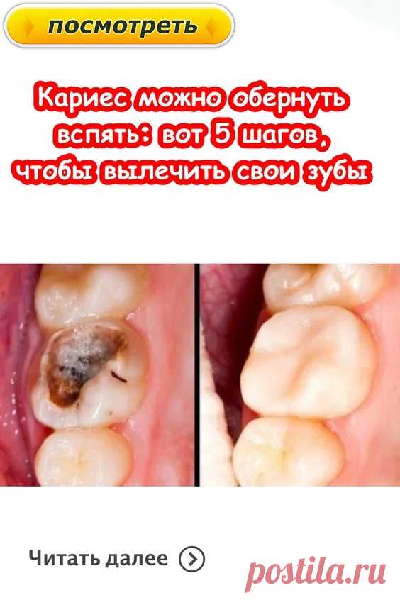 #здоровье	
#дляздоровья
#оздоровье
#проздоровье
#полезно
#спользой
#каквыздороветь
#фитнес
#упражнения
#какпохудеть
#похудение
#упражнениядляпохудения
#худеем
#хочупохудеть
#всёдляздоровья