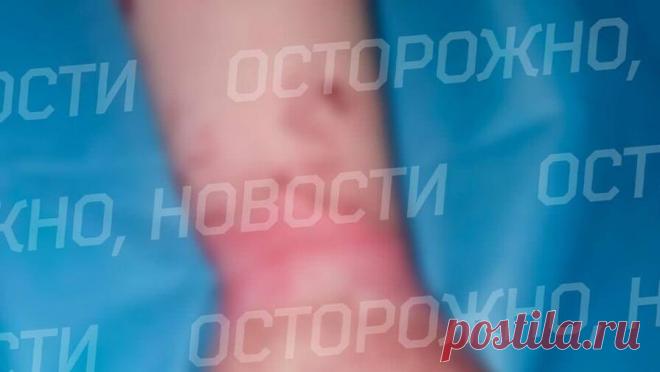 Отдыхавшая в Кении россиянка получила ожоги из-за горящей змеи. Российская туристка получила ожоги в Кении, когда местные жители подожгли рядом с ней змею. Об этом стало известно Telegram-каналу "Осторожно, новости". В ноябре 28-летняя москвичка Мария К. приехала на отдых в африканскую ...