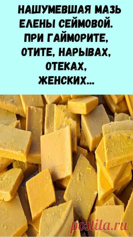 (70) Pinterest