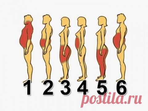 6 типов ожирения, и как справиться с каждым из них