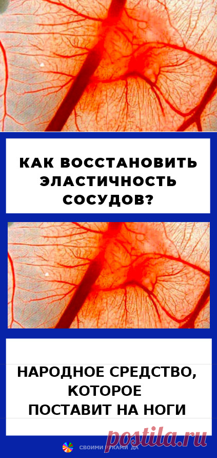 Как восстановить эластичность сосудов. Народное средство, которое поставит на ноги...