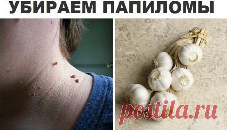Очень полезные советы
Папиломы не только нарушают внешний вид, но и опасны для организма. давайте изучим рецепт избавления от них. Оказывается чеснок является прекрасным средством для  удаления кожных образований без внешнего вмешательства или лечения.

Возьмите зубчик чеснока и нарезать его на тонкие ломтики. Накладывайте на папиломы  каждый день по несколько минут. Спустя некоторое время Вы их не обнаружите :) Надеюсь Вы воспользуетесь этими прекрасными советами.