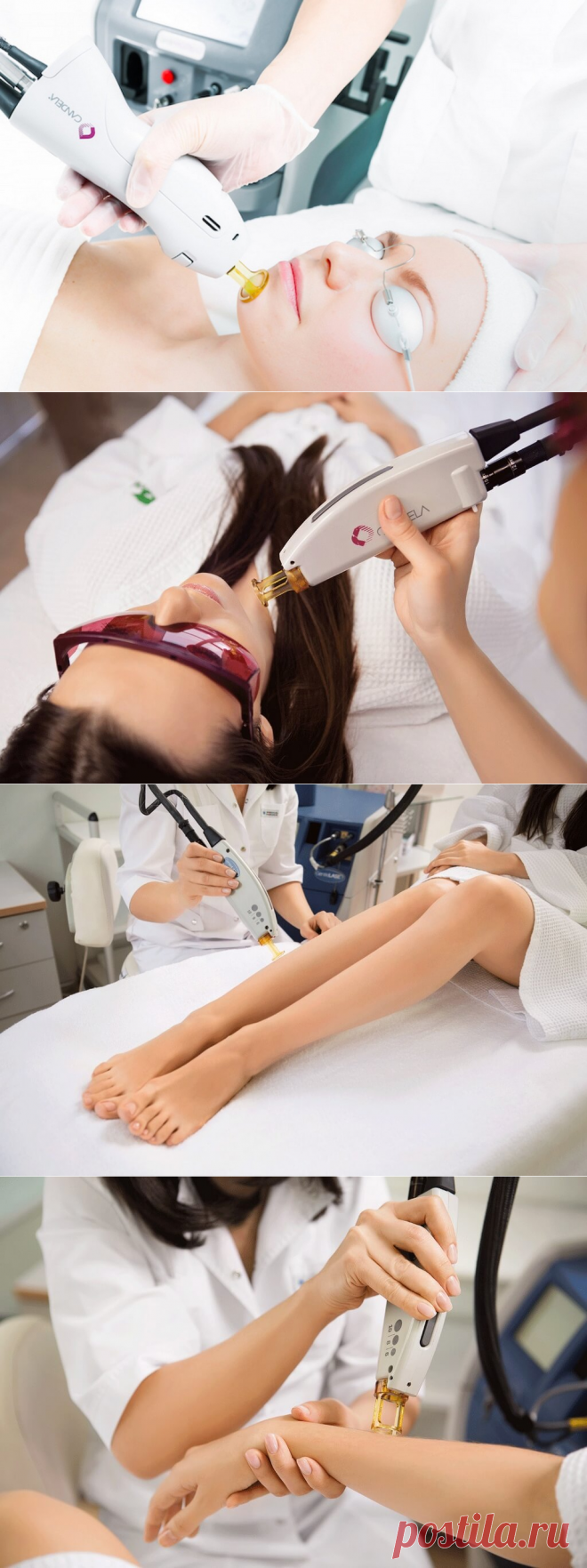 Через сколько выпадают волосы после лазерной эпиляции?