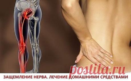 ЗАЩЕМЛЕНИЕ НЕРВА. ЛЕЧЕНИЕ ДОМАШНИМИ СРЕДСТВАМИ