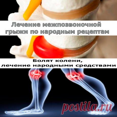 Лечение межпозвоночной грыжи по народным рецептам | Полезные советы