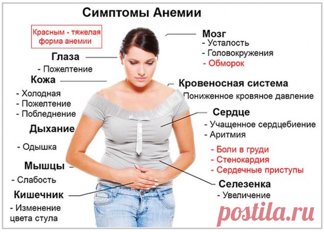 Симптомы анемии