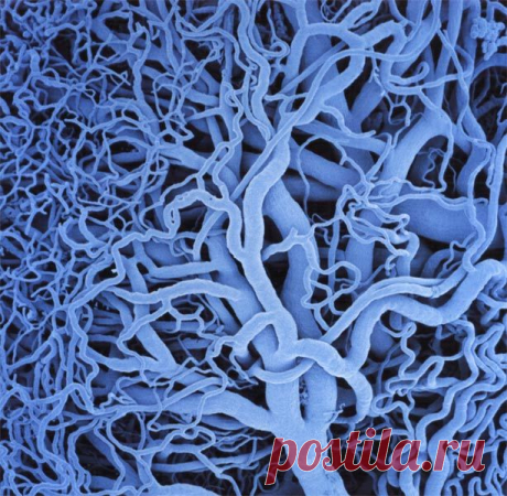 ОЧИЩЕНИЕ СОСУДОВ ГОЛОВНОГО МОЗГА.