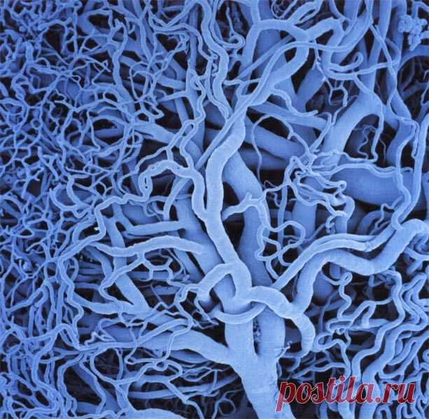 ОЧИЩЕНИЕ СОСУДОВ ГОЛОВНОГО МОЗГА.