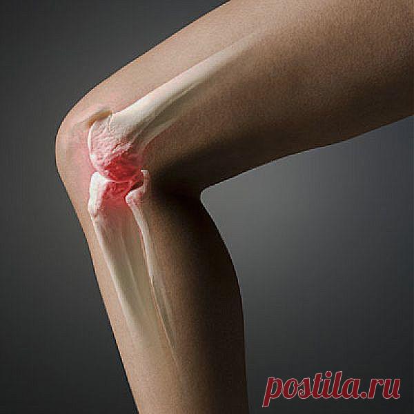 Артроз: что приводит к деформации сустава
Около 15 миллионов человек в нашей стране страдают артрозом. Однако даже среди больных «со стажем» мало людей, которые хорошо представляют себе, какие именно процессы протекают в их суставах.