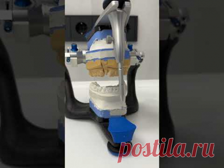 ZemsClinic.ru — импланты, коронки, исправление прикуса #shorts #лечениекариеса #стоматология