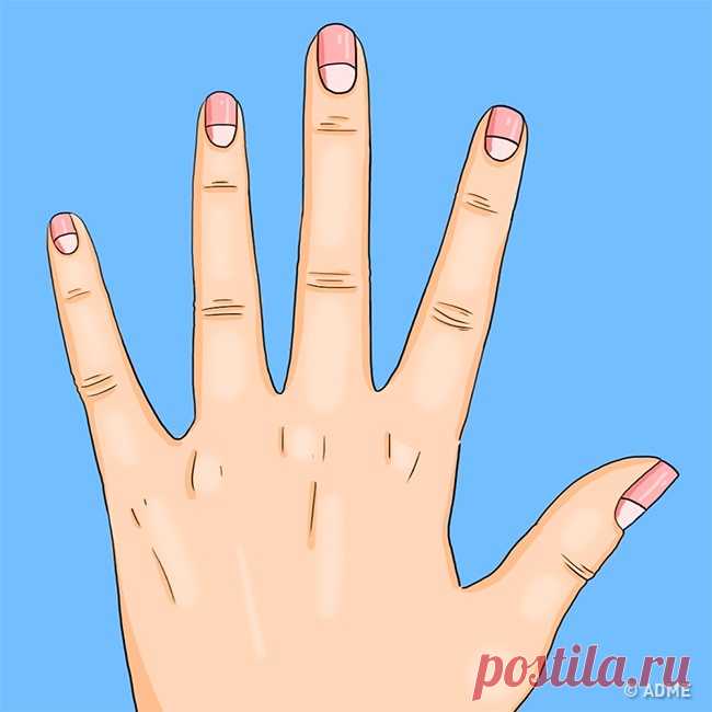13 проблем со здоровьем, о которых предупреждают лунки на ногтях...