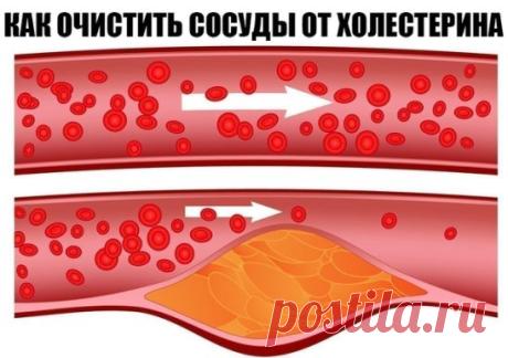 Очищаем сосуды от холестерина в домашних условиях.
1. Покупаем в аптеке цветки липы. Измельчаем их в кофемолке. И Ежедневно 3 раза в день принимаем по 1ч ложке порошка, запивая теплой водой. Курс длится 1 месяц. Вы не только снизите уровень холестерина в крови, выведите шлаки из организма, но и одновременно потеряете пару килограммов лишнего веса.
2. Обычная фасоль творит чудеса. Вечером заливае