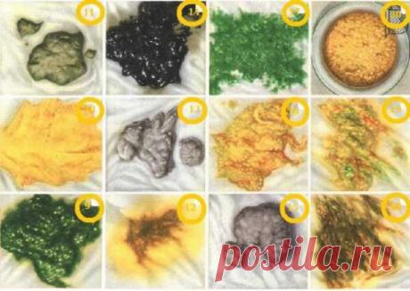 Кал темно коричневого цвета причины