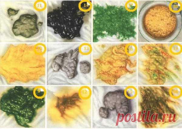 Кал темно коричневого цвета причины