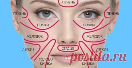 Благодаря этой китайской схеме узнала о своей болезни раньше врачей! 
 
Говорят, что глаза — зеркало души. Как глаза отражают внутренний мир, так кожа отражает состояние здоровья человека. Китайские медики считают, что каждый участок кожи связан с определенным органом. Таким образом разные высыпания, прыщи и изменение цвета кожи могут быть тревожными сигналами, которые подает наш организм.
Разоб