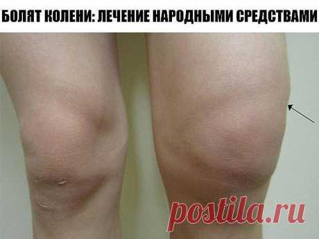 БОЛЯТ КОЛЕНИ: ЛЕЧЕНИЕ НАРОДНЫМИ СРЕДСТВАМИ
Если болят колени, нужно взять лист хрена, окунуть в кипяток, приложить на 2-3 часа к коленям. Листья хрена хорошо вытягивают соли и боль проходит. Курс лечения – 7 дней.

Если травмированы суставы на ногах: на ночь делать компрессы из раствора хозяйственного мыла.

Возьмите денатурат и керосин в равных пропорциях, слейте в стеклянную банку, положите туда 3-4 стручка свежего жгучего перца. Банку плотно закройте, поставьте настаива...