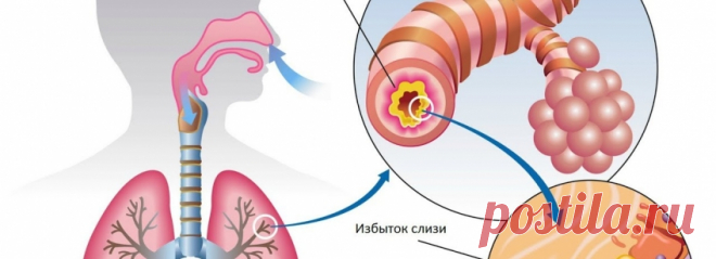 Выгоняем слизь и мокроту из горла и груди без таблеток: пять работающих средств | Волковыск.BY