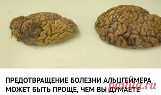 ПРЕДОТВРАЩЕНИЕ БОЛЕЗНИ АЛЬЦГЕЙМЕРА МОЖЕТ БЫТЬ ПРОЩЕ, ЧЕМ ВЫ ДУМАЕТЕ