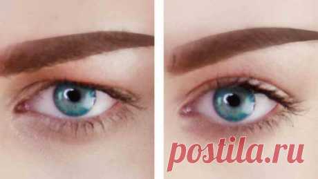 Нависшее веко: 5 эффективных приёмов, чтобы избавиться от этой проблемы - Сайт для женщин 5 средств против опущенных век Глаза могут многое сказать о своей обладательнице, ровно, как и показать степень ее ухоженности. Опущенные веки всегда были знаком уставшей и измученной женщины, однако, это не всегда так. Просто кожа век очень тонкая и нежная, а плюс ко всему подвержена негативным воздействиям окружающей среды. Веки быстро стареют, что сильно сказывается …