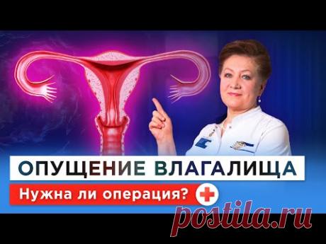 Что делать при опущении матки и влагалища? Симптомы, упражнения, бесплатное лечение и по ОМС