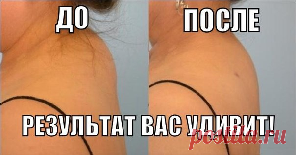 КАК ИЗБАВИТЬСЯ ОТ ХОЛКИ НА ШЕЕ! После нескольких процедур шея вновь станет гибкой и красивой! - Женский Журнал У многих женщин после 35-40 лет в области седьмого шейного позвонка часто появляется «холка» — жировые отложения у основания шеи. «Холка» способна сдавливать артерии, что может привести к гипоксии (нарушению кровоснабжения) головного мозга и воротниковой зоны. Чтобы ее убрать: Необходимо смешать в стакане 3 ст.л. оливкового масла и 1 сырое куриное яйцо, добавить столько же …