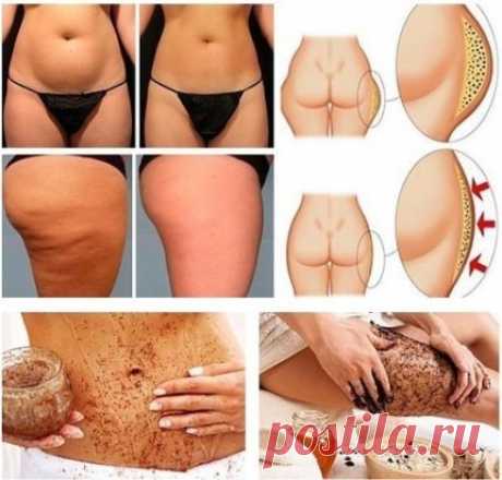 УБИРАЕМ ЖИР С НОГ И ЖИВОТА
Девочки! Нашла просто чудодейственный способ убрать "животик" и уменьшить бедра на 2 размера! За 1 неделю сбросила 5 килограмм и все это без изнурительных тренировок и диет! Не верите? Смотрите сами - оставляю рецептик!
Когда настойчивое желание изменить собственную внешность перерастает уже в необходимость, все мы начинаем искать всяческие способы быстрого похудения и улучшения внешнего вида тела. В борьбе за прекрасную фигуру настоятельно реком...