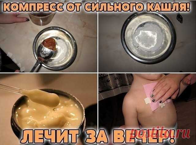 Компресс от сильного кашля!