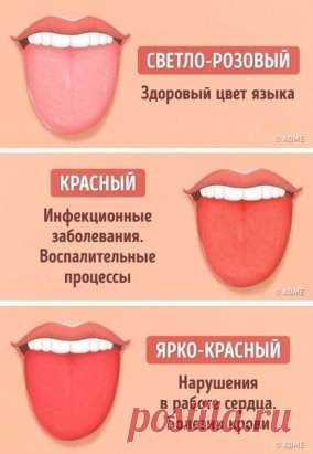 12 проблем, о которых может рассказать цвет языка.