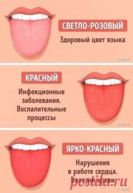 12 проблем, о которых может рассказать цвет языка.