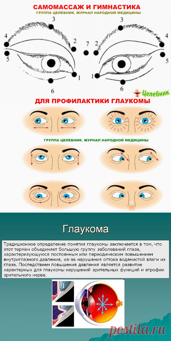 (46) Одноклассники     Глаукома – опасное заболевание глаз,
