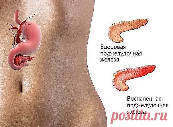 ЕСЛИ БЕСПОКОИТ ПОДЖЕЛУДОЧНАЯ ЖЕЛЕЗА


Есть способ не только облегчить страдания, но и навсегда забыть о этой напасти..... Это семя льна..., оно единственное! способно вылечить вашу поджелудочную железу. 


Нужно: 


Свежемолотую столовую ложку семян льна заварить 0,5 стакана кипятка.... Дать потомиться на слабом огне 5 минут при закрытой крышке и оставить остывать в таком состоянии..... а тёпленьким, как остынет - выпить этот киселек вместе со всеми шелушками от семени за ...