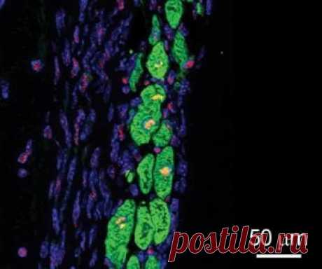 Сердце после инфаркта восстановят с помощью специальной заплатки | Human psychology