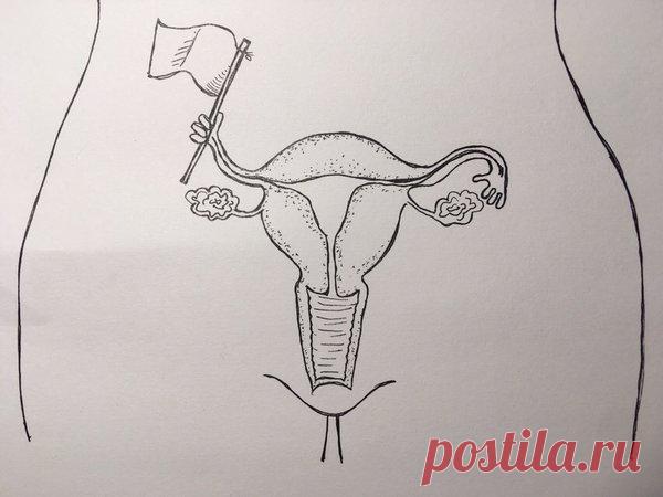 Как не умереть от рака шейки матки | ШБмнк | Яндекс Дзен