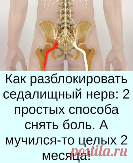 Как разблокировать седалищный нерв: 2 простых способа снять боль. А мучился-то целых 2 месяца!