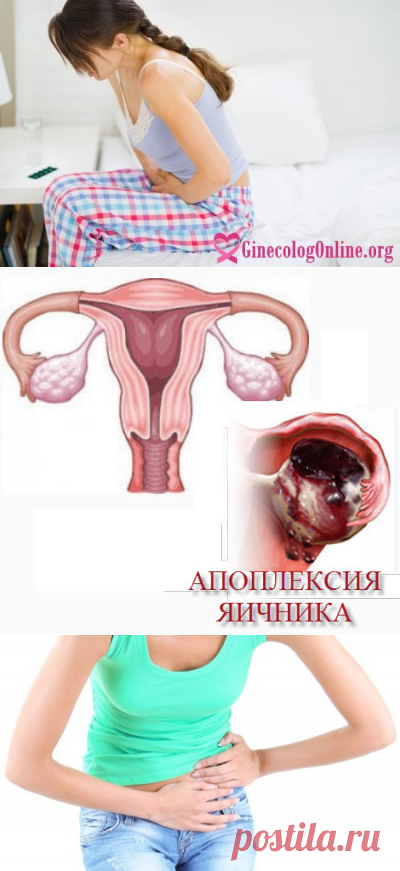 Апоплексия или разрыв яичника - симптомы, лечение и последствия