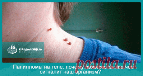 Почему появляются папилломы на теле о чем сигналит организм?