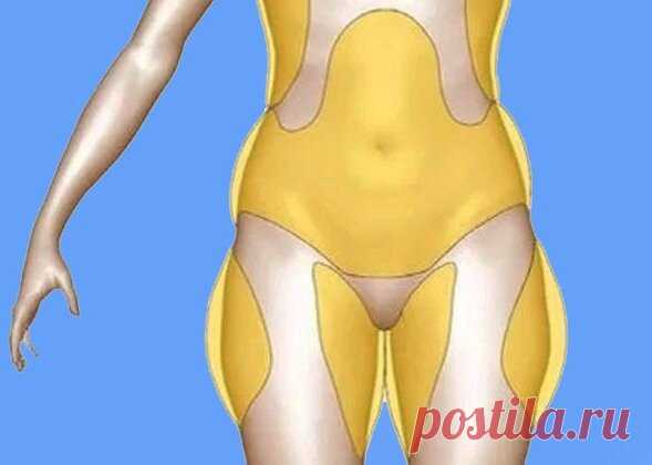 Три упражнения для борьбы с ушами между ног. | Women's health and sport | Яндекс Дзен