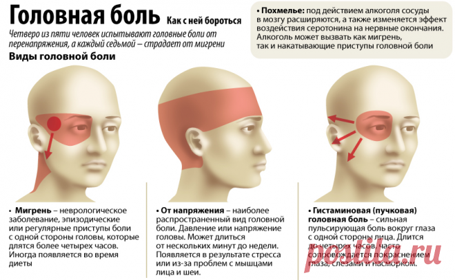 Что провоцирует головную боль »