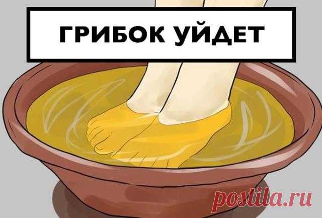 ВЫ ОНЕМЕЕТЕ! ГРИБОК ЗАСОХНЕТ ПОД КОРЕНЬ, ЕСЛИ… Всего два ингредиента помогут вам забыть о грибке ногтей! Я забыла, что это такое! Грибковая инфекция проявляется по разному — пожелтение, отслаивание