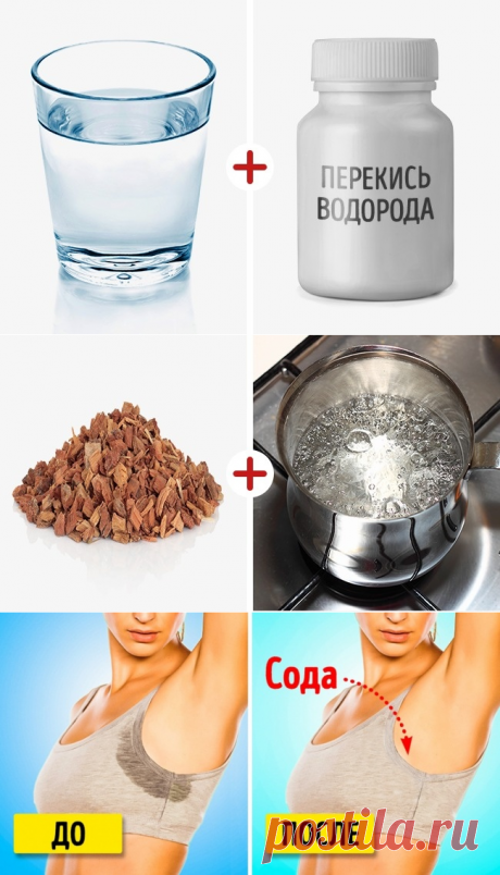 8 проверенных способов избавиться от повышенной потливости