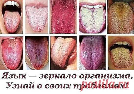 (2) Одноклассники