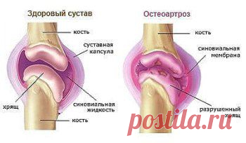 (57) Одноклассники