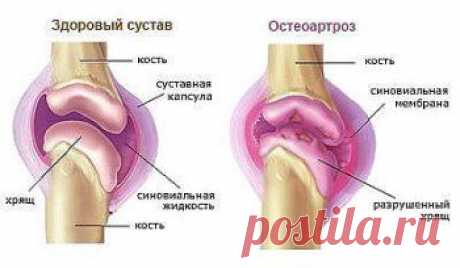 (57) Одноклассники