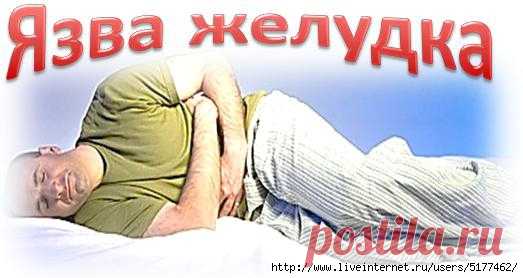 Язва желудка и двенадцатиперстной кишки: 19 СУПЕР эффективных народных средств
